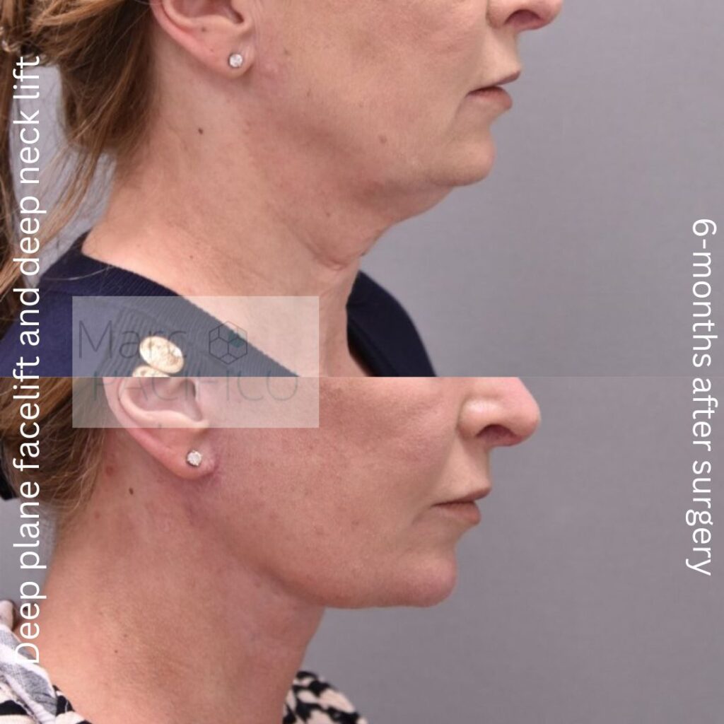 Actual patient results