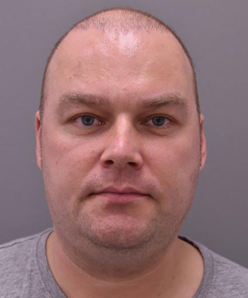 Case--5490 | After Brow Lift Surgery