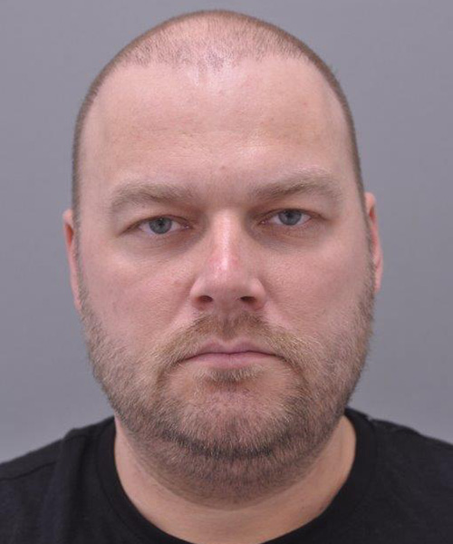 Case--5490 | Before Brow Lift Surgery